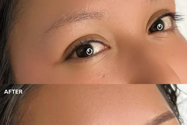 Wet Healing Vs Dry Healing For Microblading