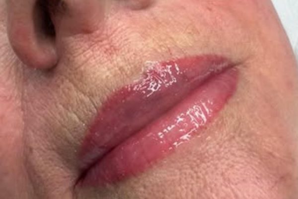 How Long Should I Wait After Lip Fillers Before Booking A Lip Liner Tattoo?