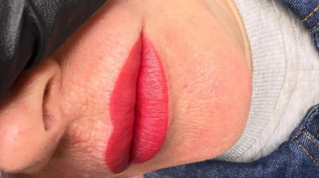 before and after lip scar camouflage