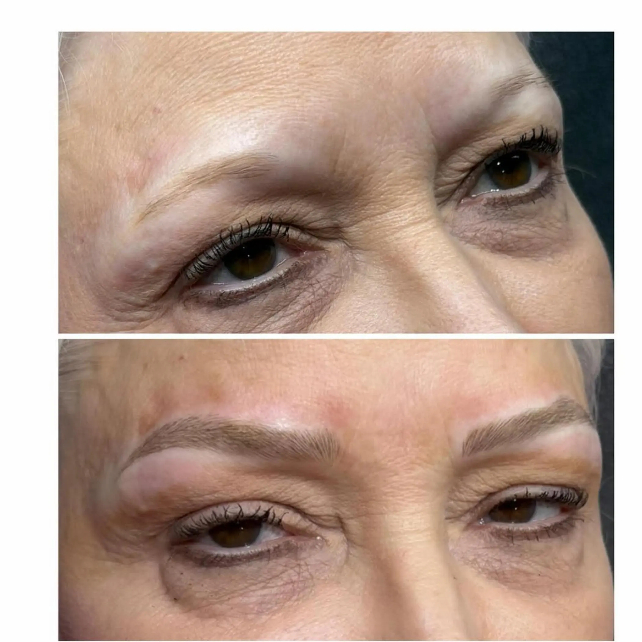 close up eyebrow stroke details healed skin