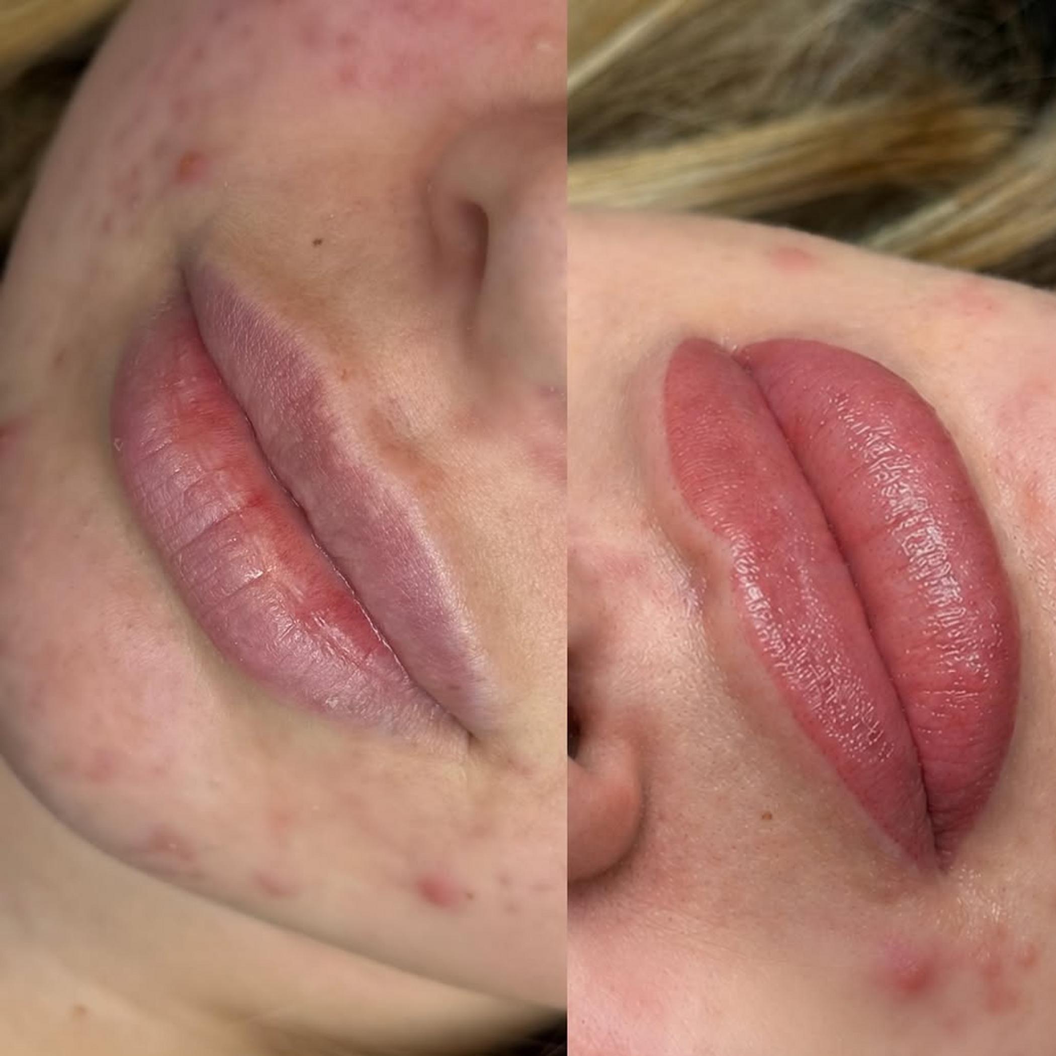 close up healed lip blush details