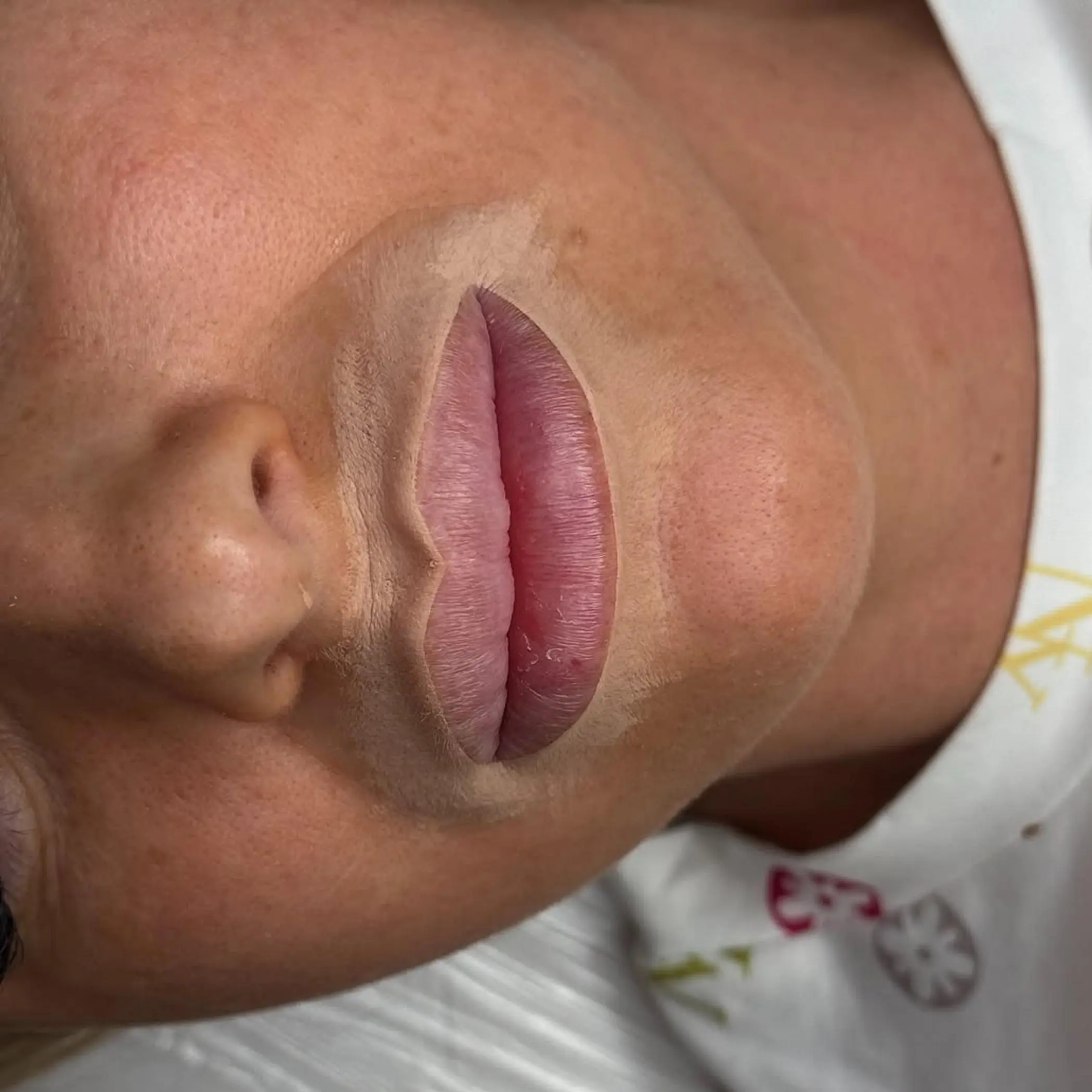 close up split lip scar detail