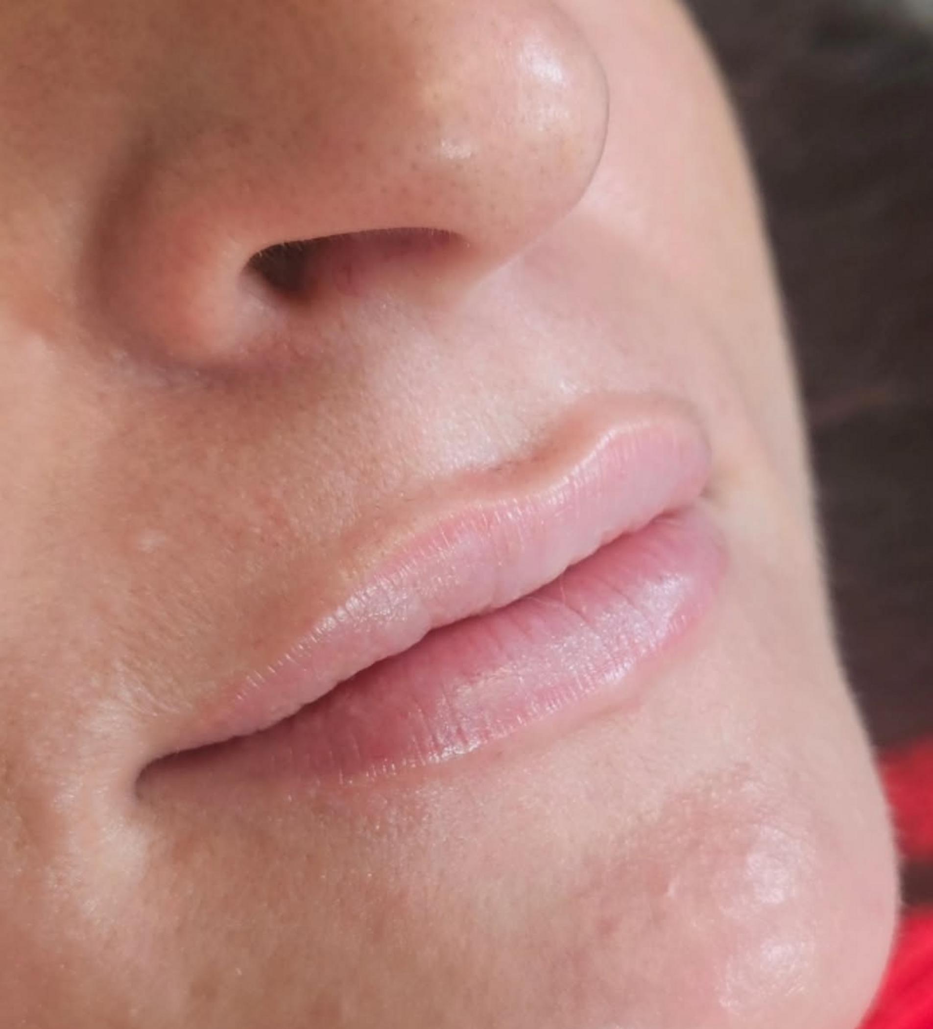 healing stage pale lip tattoo skin