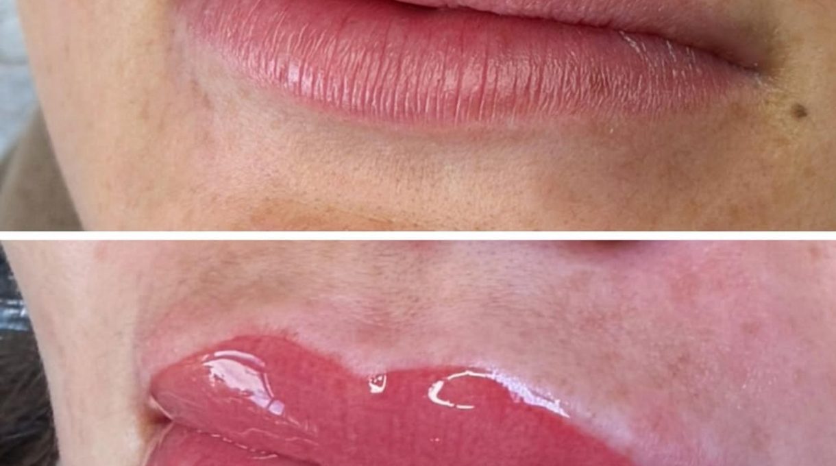 lip liner tattoo before after melbourne