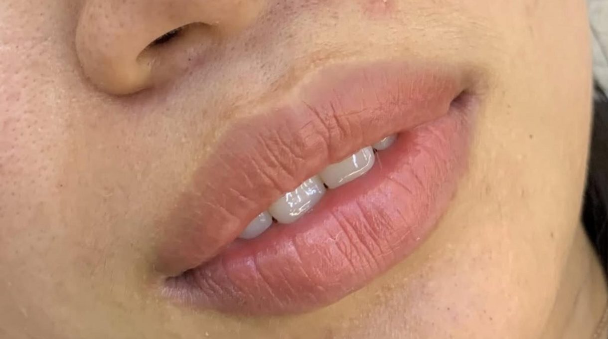 lip liner tattoo before after melbourne