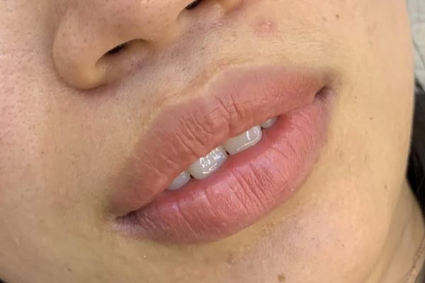 Lip Liner Tattoo Cost Australia Guide