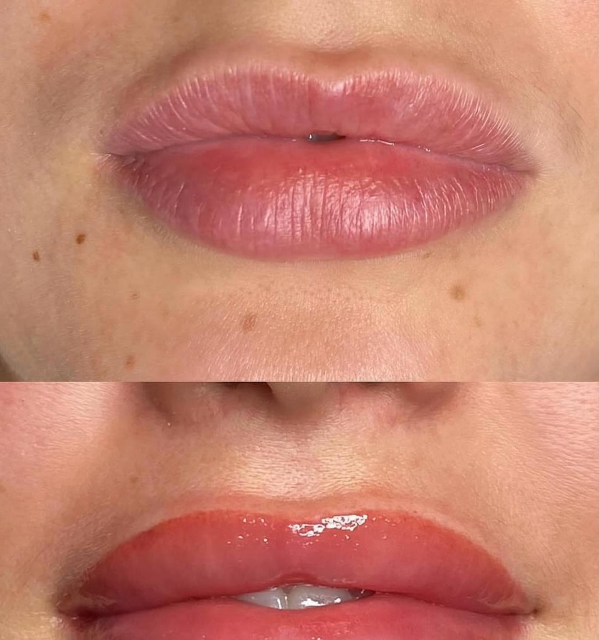 lip liner tattoo procedure step