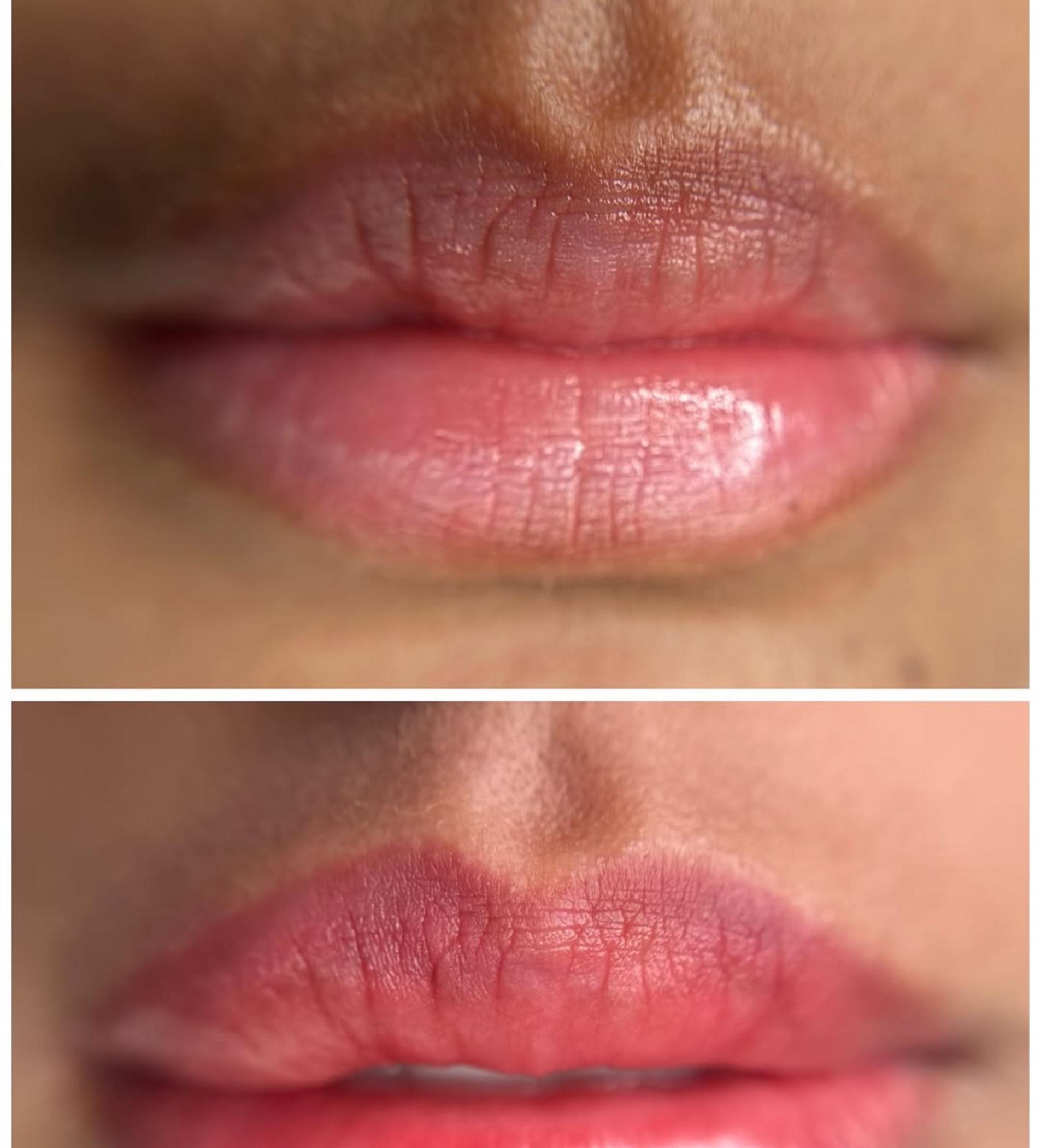 lip tattoo correction before after