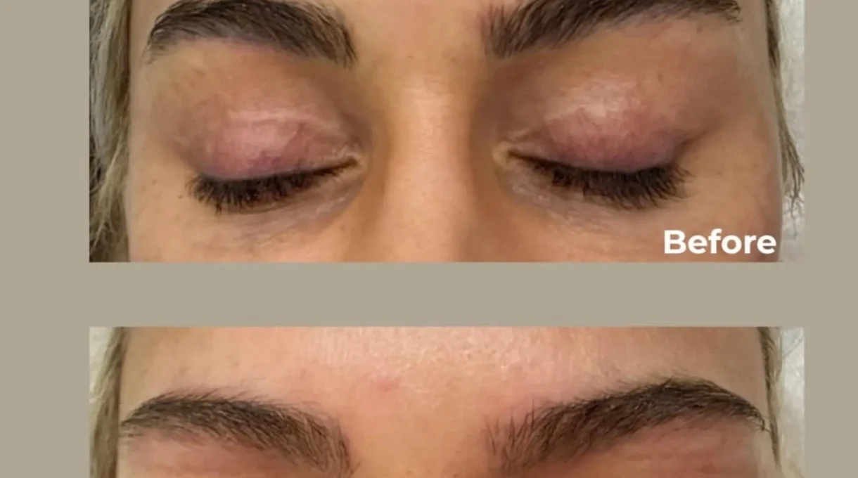 powder brows before and after melbourne