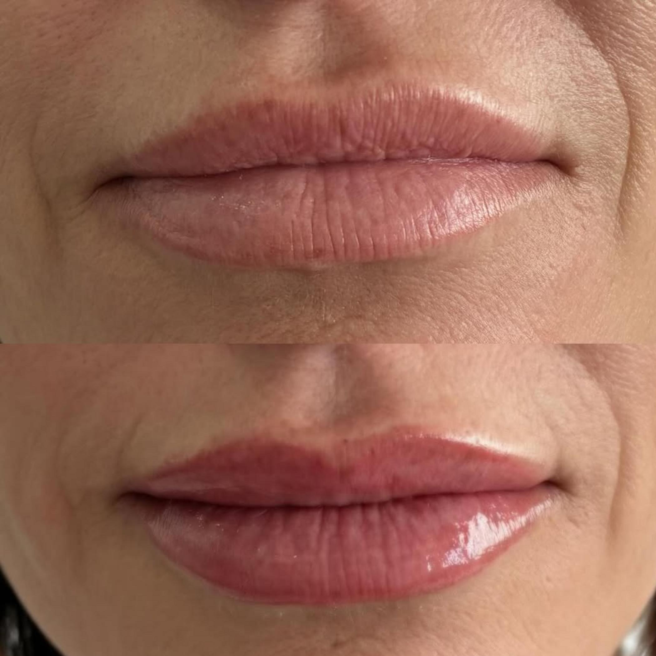technician applying lip liner tattoo