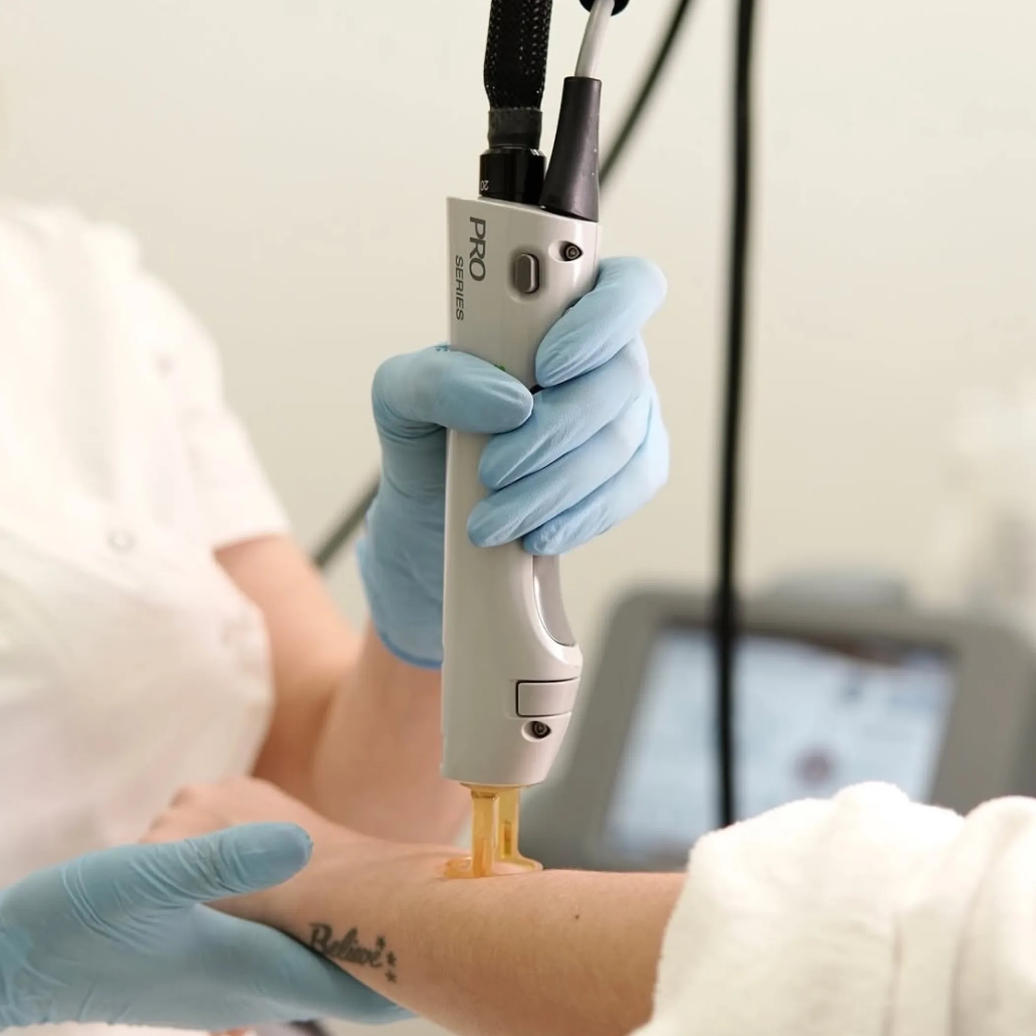 ipl hair removal device in use